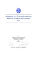 Measuring eye deformations under different patient positions using MRI