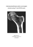 Individual identification within commingled remains using CT and DEXA scans