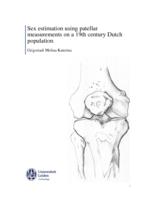 Sex estimation using patellar measurements on a 19th century Dutch population